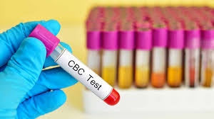 CBC Complete Blood Count